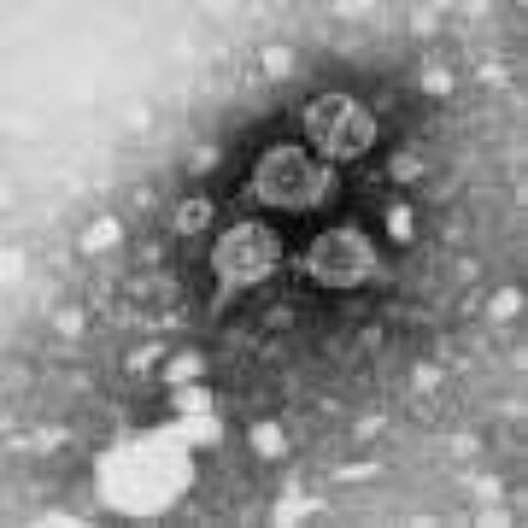 RFK Jr. wants to delay the hepatitis B vaccine—here’s what parents need to know