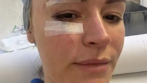 ‘Don’t look if you’re squeamish’ – Laura Woods shares graphic pictures of horror lampshade accident