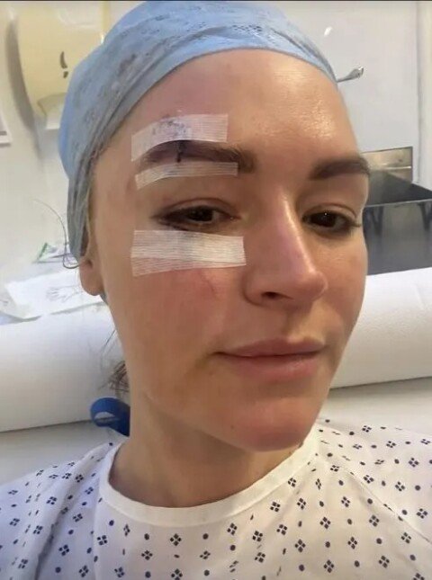 ‘Don’t look if you’re squeamish’ – Laura Woods shares graphic pictures of horror lampshade accident