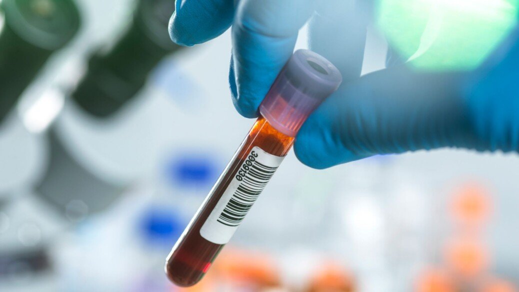 Scientists have identified a ‘protein signature’ in blood that could predict healthy aging