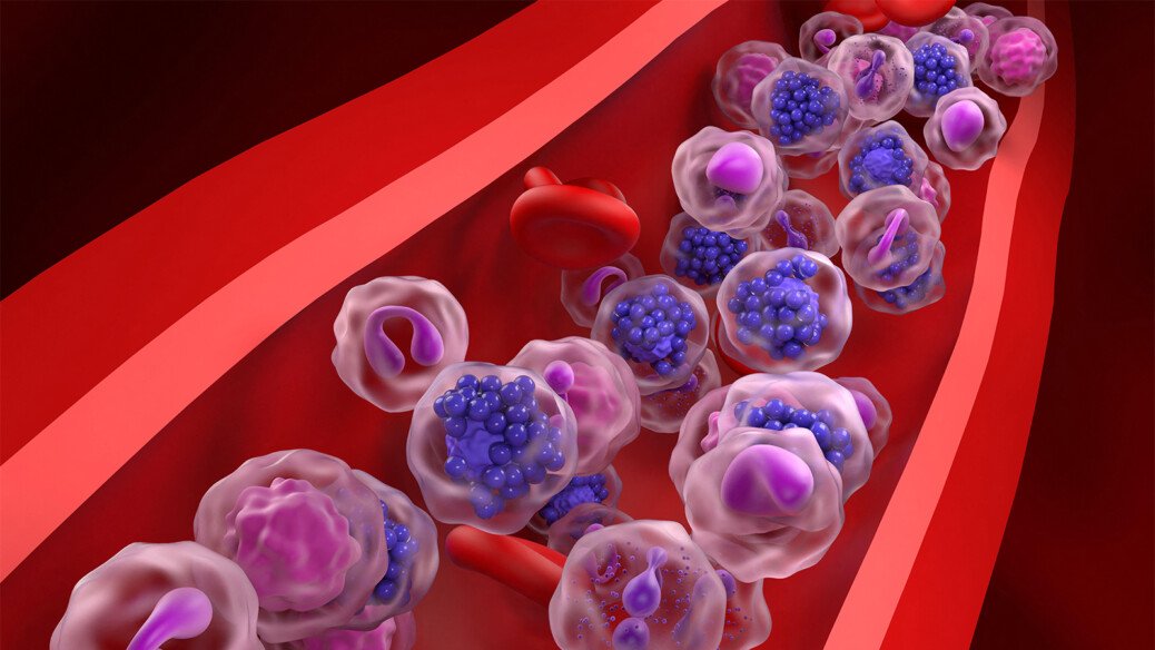 A Deep Dive Into Double-Hit Lymphoma